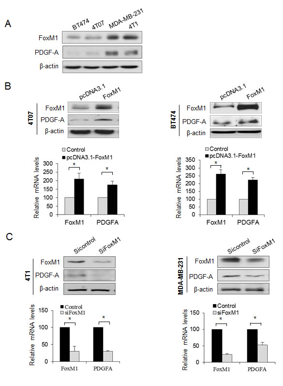 FoxM1 promotes PDGF-A expression in breast cancer cells.