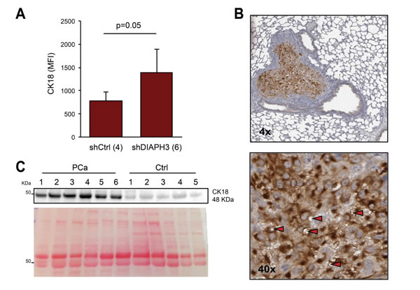 CK18 is a marker of large oncosomes