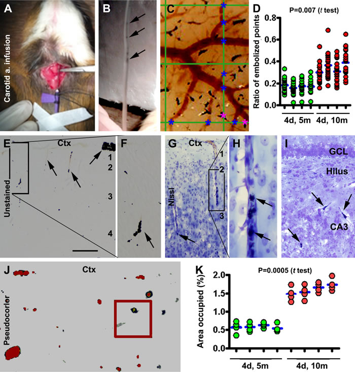 Modeling and characterization of cerebral microembolism in guinea pigs.