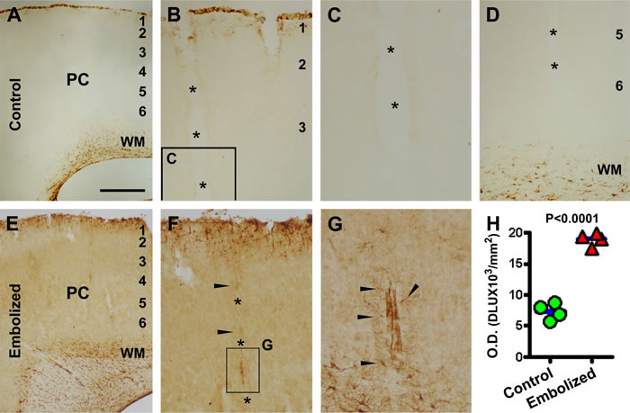 Representative images and densitometry showing increased glial fibrillary acidic protein (GFAP) immunoreactivity (IR) in the embolized cerebral cortex relative to control.