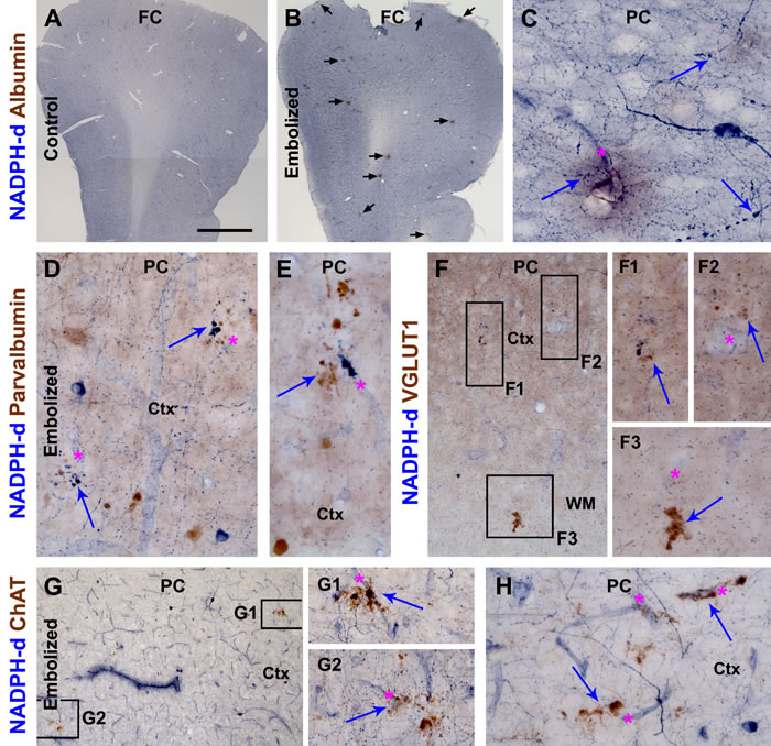 Cerebral vascular injury and neuritic pathology in guinea pigs surviving 30 days post embolization.