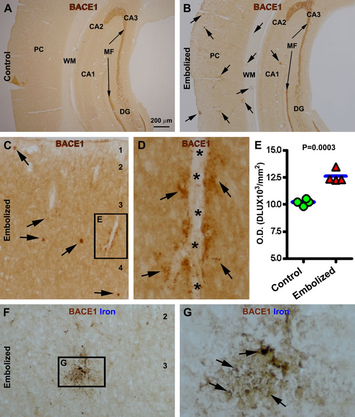 Localized increase of &#x3b2;-secretase-1 (BACE1) immunoreactivity (IR) in embolized cerebrum relative to sham-operated control 14 days post operation.