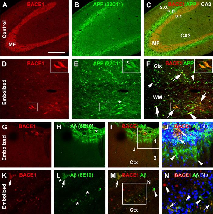 Confocal double immunofluorescent characterization of amyloidogenic proteins in the cerebrum of embolized relative to control guinea pigs surviving 30 days.