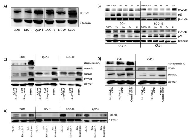 Western blot analysis of FOXM1 and potential target expression in GEP-NEN cell lines .