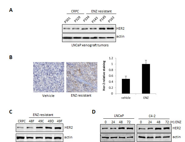 HER2 is overexpressed in ENZ-resistant tumors and cells and induced by ENZ.