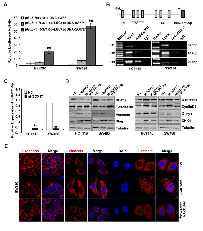 SOX17 transcriptionally regulates miR-371-5p in CRC cells and is sufficient to suppress EMT by regulating miR-371-5p.