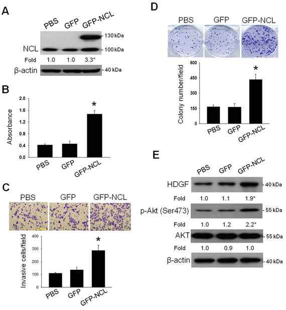 Influence of NCL overexpression on the oncogenic behaviors and HDGF/Akt signaling in hepatoma cells.