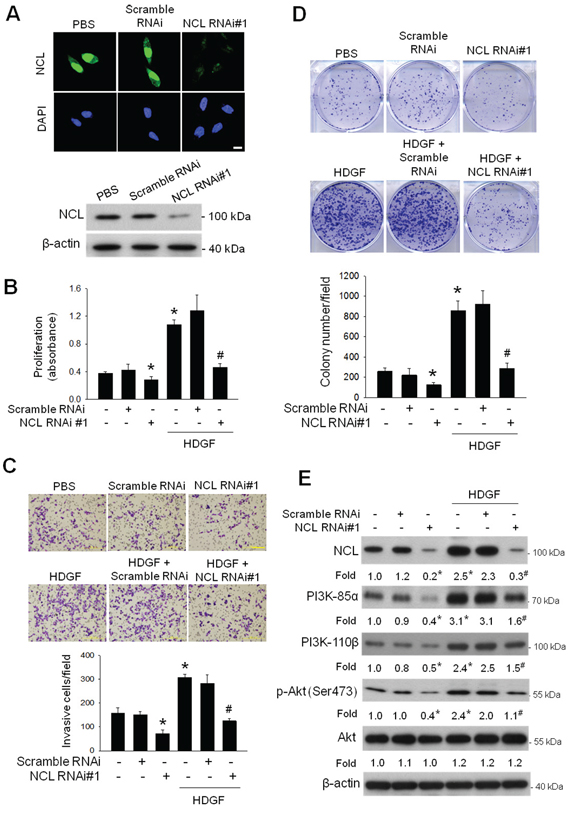 Effect of NCL knockdown on the basal and HDGF-stimulated oncogenic behaviours and PI3K/Akt signaling of hepatoma cells.