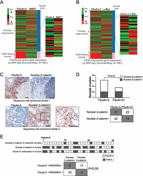 Fibulin-5 silencing is correlated with activation of the Wnt/&beta;-catenin pathway in lung cancer.