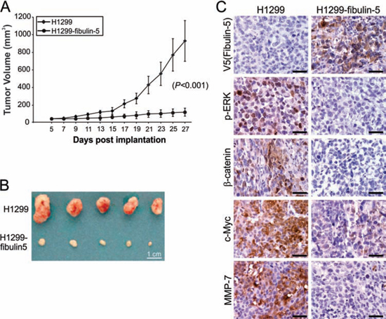 Fibulin-5 inhibits lung tumor progression and the Wnt pathway in mice.