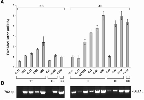 SEL1L expression levels by qRT-PCR and analysis of SEL1L alternative transcripts in GBM cell lines.