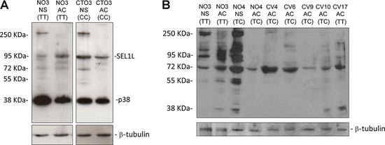 Western blotting analysis for SEL1L in GBM cell lines.