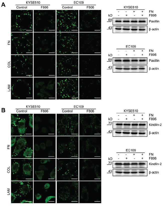 F806 inhibits focal adhesion formation in ESCC cells.