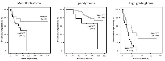 Kaplan Meier survival curves using R2 analysis software showing the overall survival probability for high (black) versus low (grey)