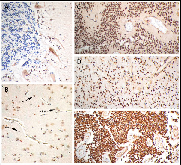 PARP1 immunohistochemistry on paraffin embedded sections.