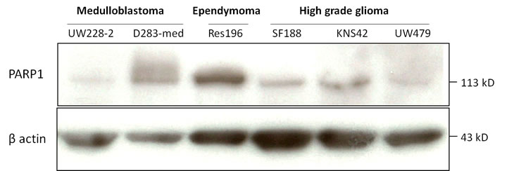 Immunoblot of baseline PARP1 (113 kD) and beta actin (42 kD) expression in pediatric brain tumor cell lines.