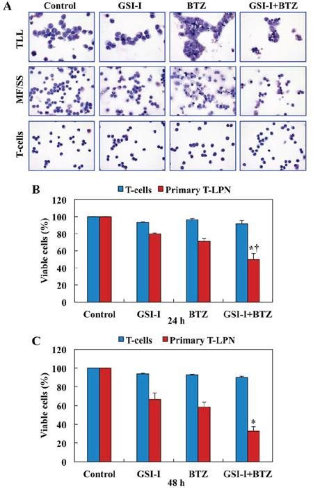 Combined treatment with GSI-I and BTZ induces apoptosis and decreases the viability of primary T-LPN, but not of normal human T lymphocytes.