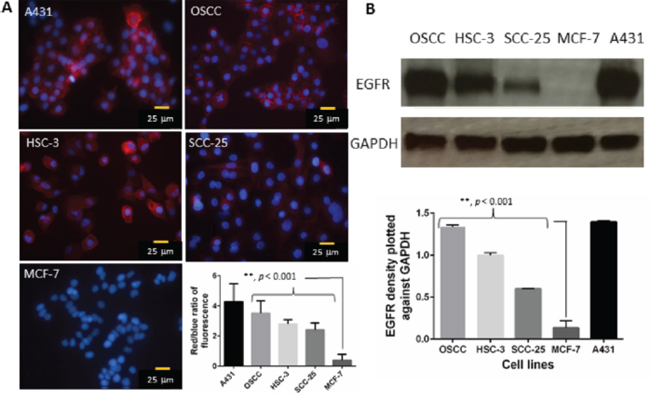 A. Representative immunofluorescence images show the expression of EGFR in A431 (positive control), OSCC, HSC-3, SCC-25 and MCF-7 cells (negative control).
