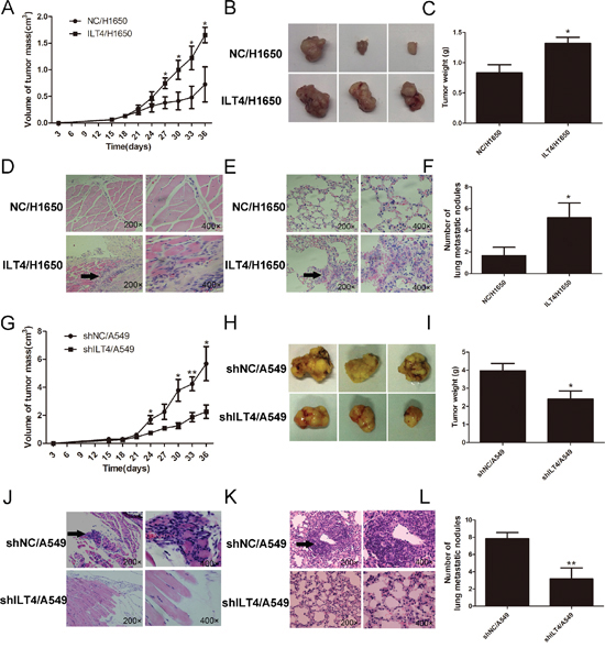 ILT4 drives NSCLC tumor growth and metastasis in vivo.
