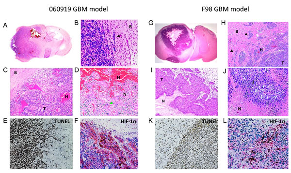 Histological characterization of the intracranial human xenograft 060919 and syngeneic rat F98 GBM models.