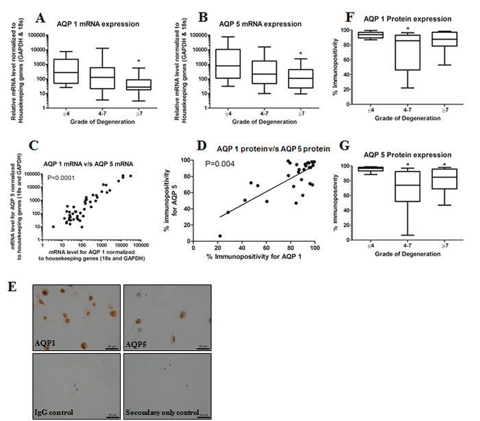 AQP expression decreases with degeneration in human intervertebral disc samples.