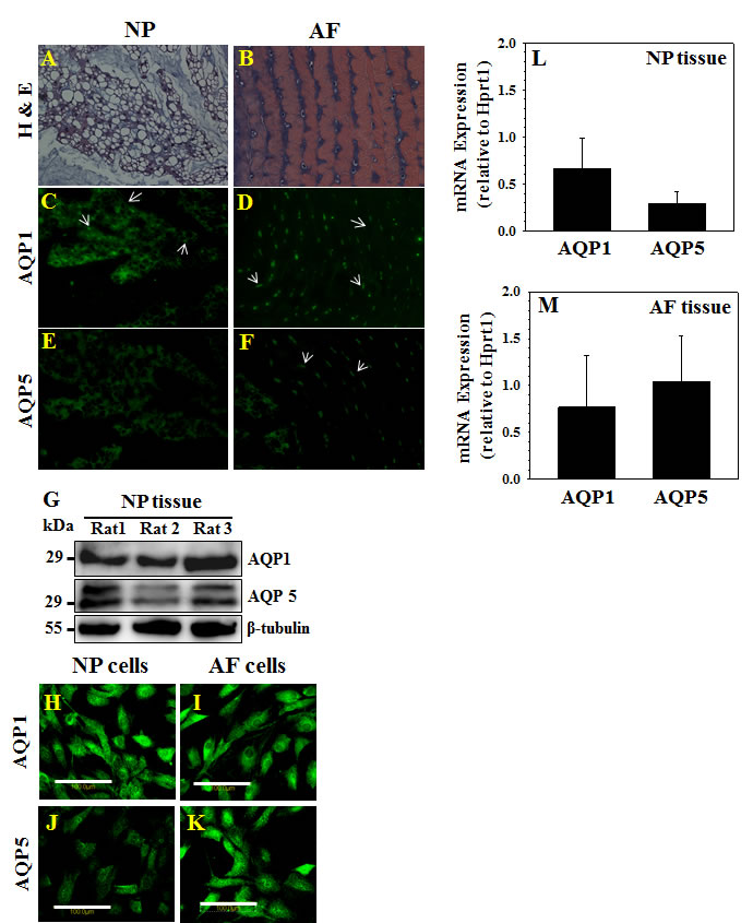 AQPs 1 and 5 are expressed in healthy rat disc.