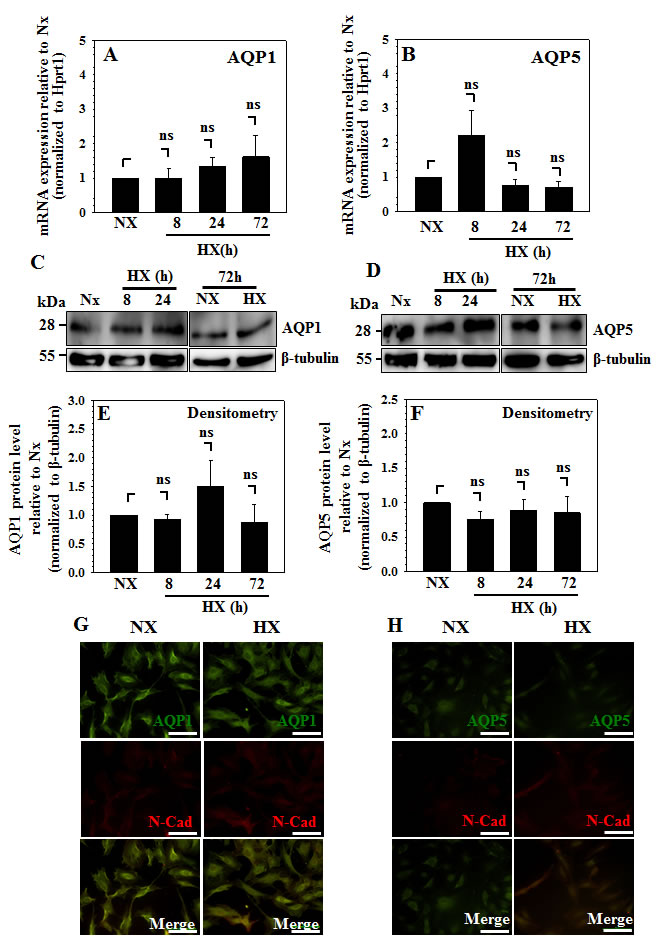Expression of AQPs 1 and 5 is refractory to hypoxia in NP cells.
