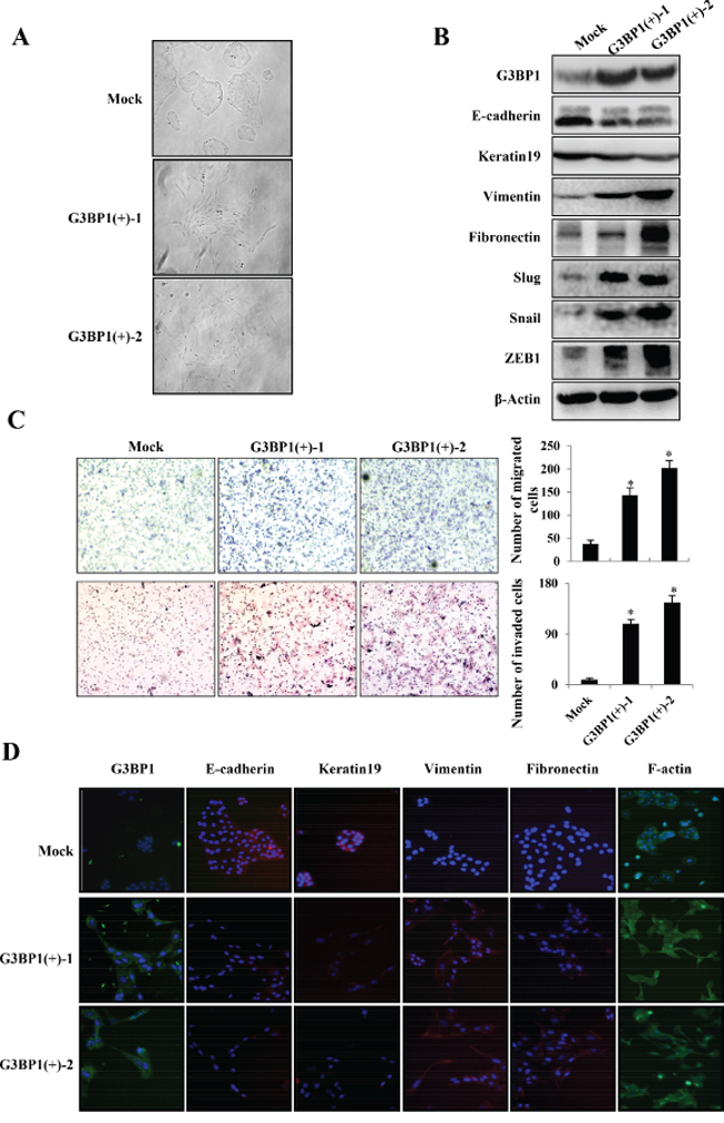 Stable overexpression of G3BP1 induces the EMT and enhances the migration and invasion of MDCK cells.