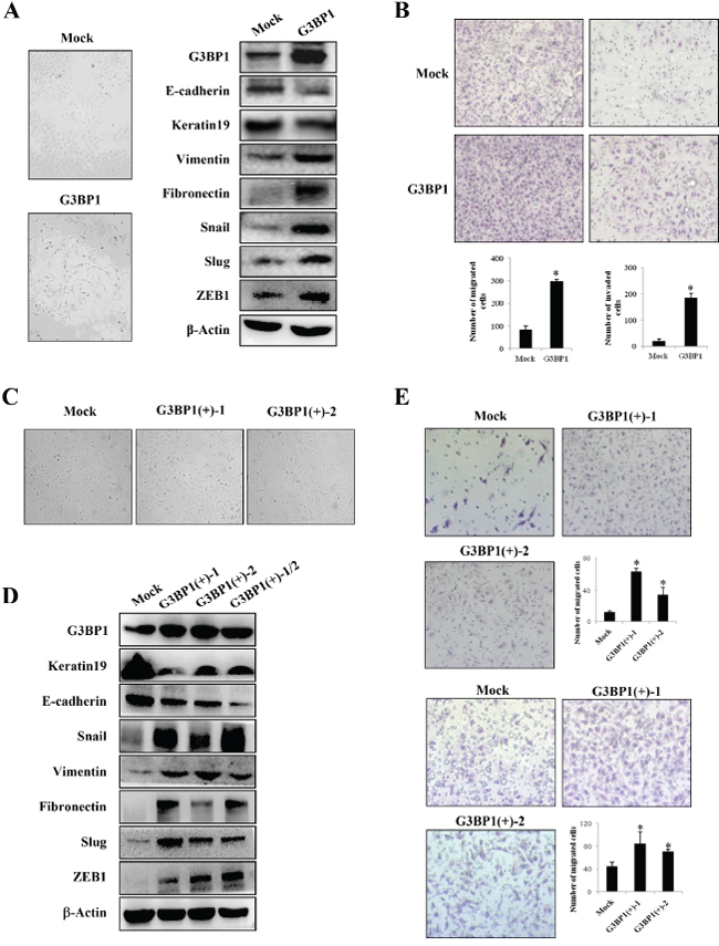 Overexpression of G3BP1 induces the EMT and enhances the migration and invasion of MCF-7 cells.