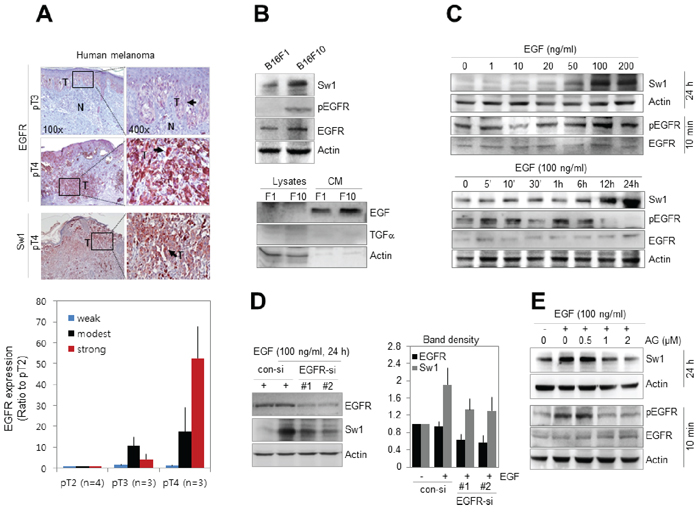Swiprosin-1 expression is regulated by EGF signaling in melanoma.