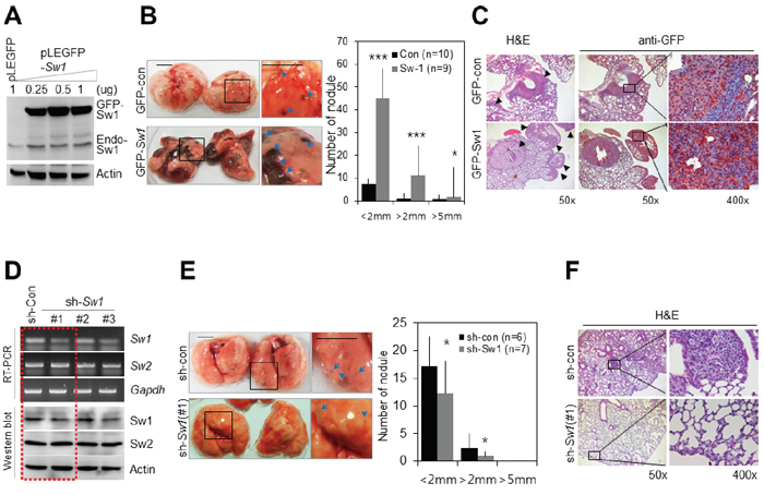Swiprosin-1 regulates metastasis of B16F10 melanoma in vivo.