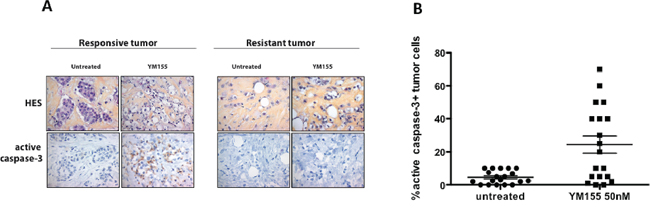 YM155 induces cell death in primary breast cancer cells using an organotypic 3D assay.