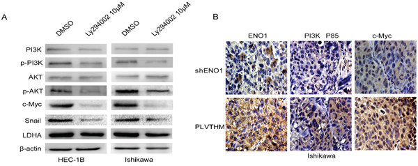 ENO1 regulates PI3K/AKT pathway and its downstream signal moleculars in EC.