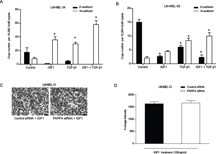 IGF1 induces Epithelial-to-Mesenchymal Transition (EMT) in human melanoma.