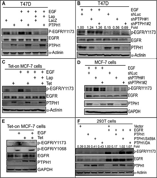 PTPH1 dephosphorylates EGFR at Y1173 in breast cancer cells.