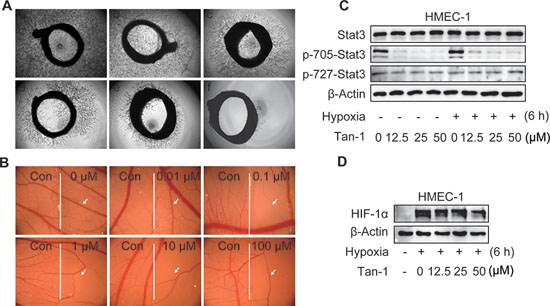 Tanshinone-1 (Tan-1) inhibits angiogenesis and reduces p-705-Stat3 and HIF-1&#x03B1; in HMEC-1 cells.