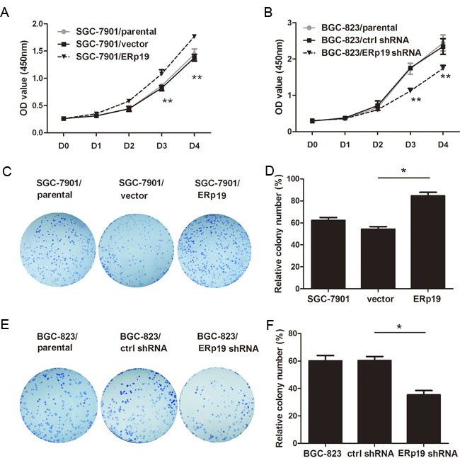 Effects of ERp19 on cell growth in human gastric cancer cells.
