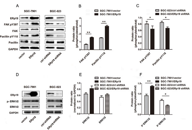 Effects of ERp19 on the phosphorylation levels of FAK/paxillin and ERK1/2 in gastric cancer cells.