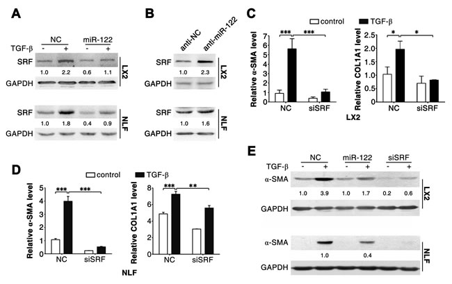 Silencing of SRF attenuates the effect of TGF-&#x3b2; in LX2 and NLFs.