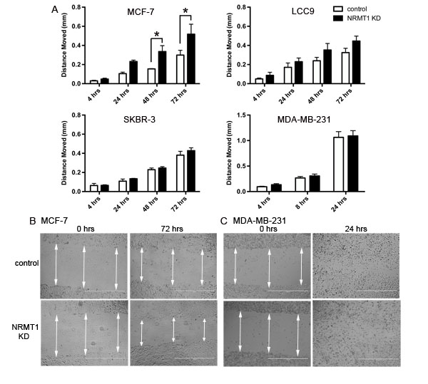 Knockdown of NRMT1 in ER positive breast cancer cell lines also increases wound filling capacity.