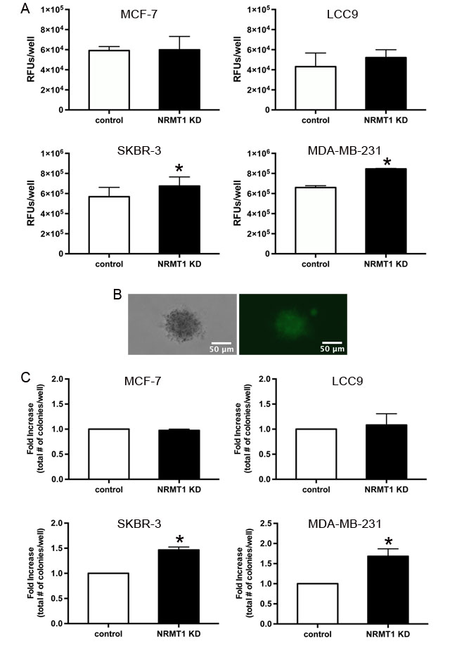 Knockdown of NRMT1 promotes invasive potential and anchorage independent growth of ER negative breast cancer cells.