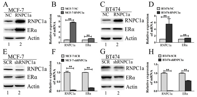 ER&#x3b1; expression was influenced by RNPC1 in ER positive breast cancer cells.