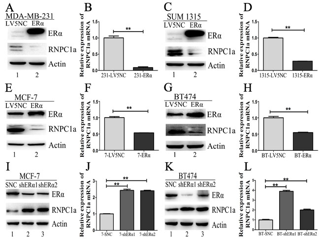 ER&#x3b1; could reversely regulate endogenous RNPC1 expression.