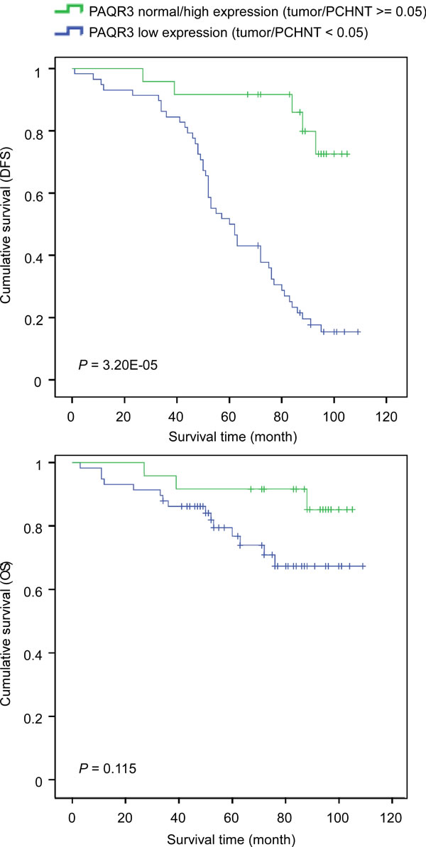 Correlation of PAQR3 expression level with survival of breast cancer patients.