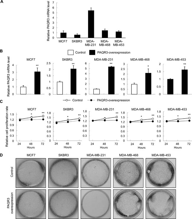 PAQR3 overexpression reduces cell growth and colony formation of human breast cancer cells.