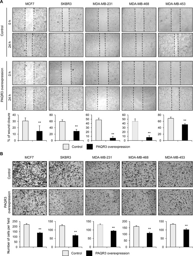 PAQR3 overexpression decreases migration of breast cancer cells.