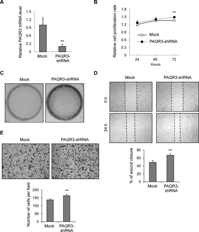 Knockdown of PAQR3 in MDA-MB-231 cells enhances cell growth and migration.