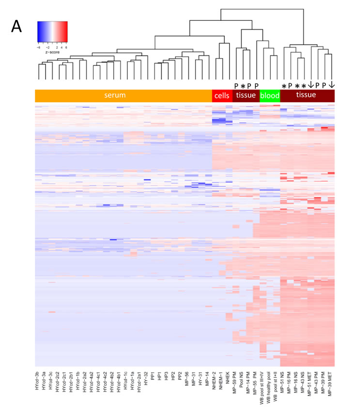 MiRNA profiling of melanoma samples.