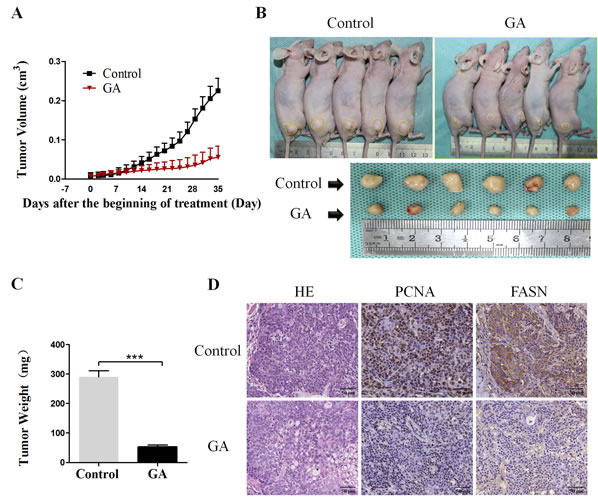 GA prevents the subcutaneous xenograft tumor growth and the expression of lipogenic enzyme