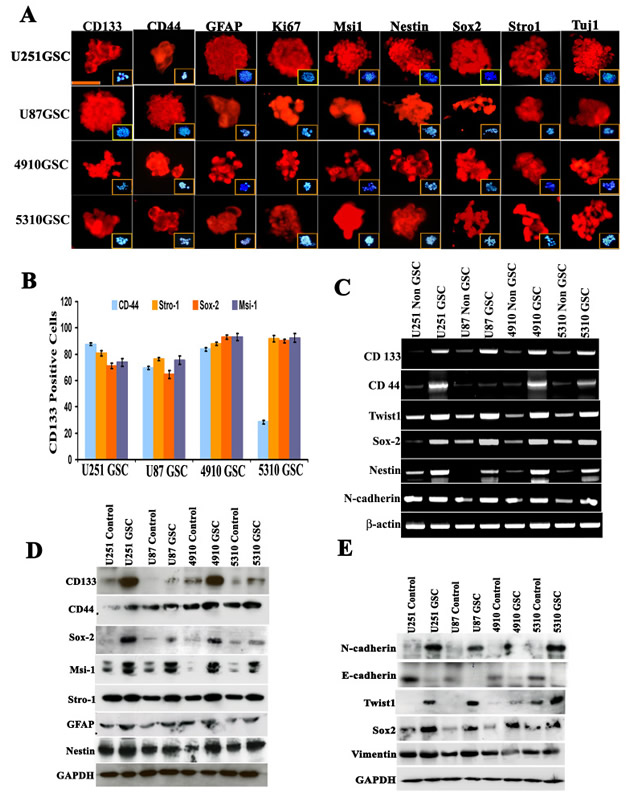 Evaluation of stem cell-like characteristics of U251, U87, 4910 and 5310 neurospheres.